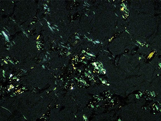 1633660666501707.jpg 淀粉樣蛋白.jpg